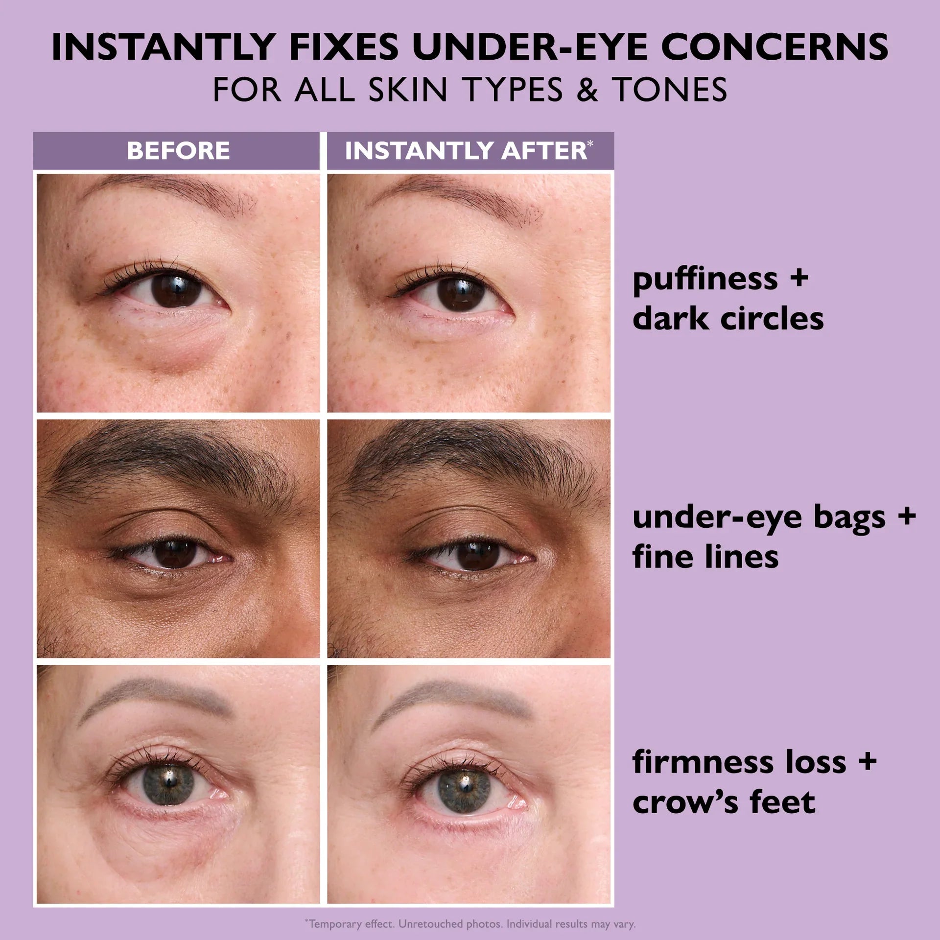 Glamish Instant Eye Tightener Easy-Wear Formula - Lift and Firm Pakistan